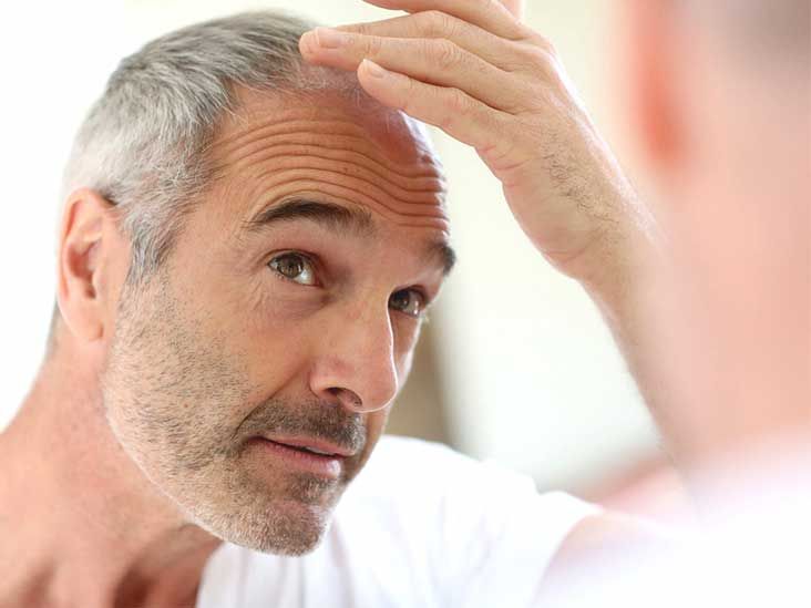 thinning hair in men