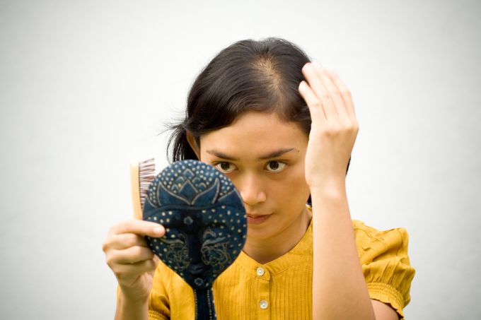 Worried about hair loss