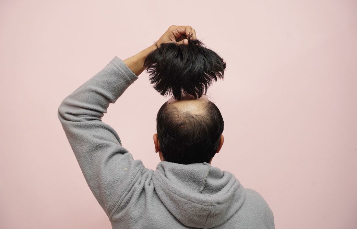 The Complete Guide to Choosing the Perfect Toupee for Men