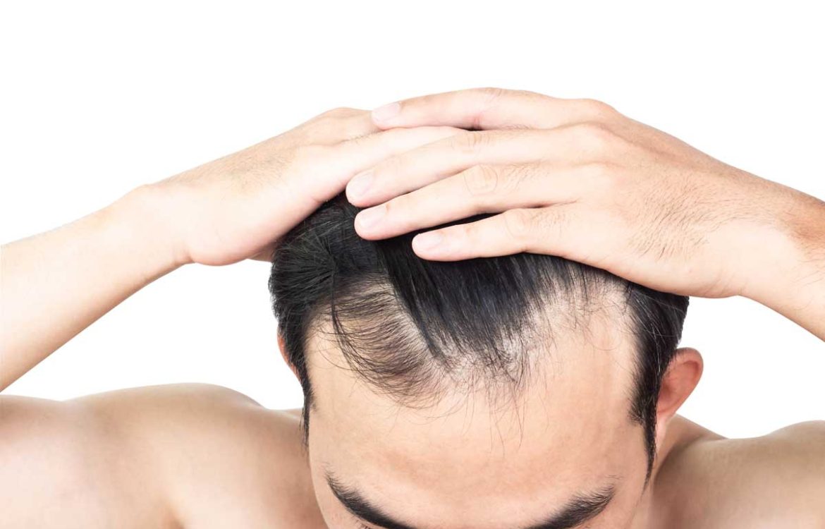 Toupees vs. Hairpieces: Decoding the Differences and Finding Your Fit